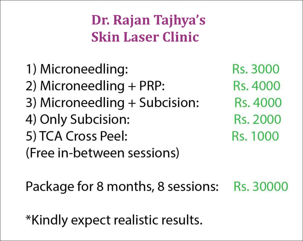 Acne scar treatment in Nepal